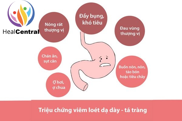 Thuốc Ibutop 50 điều trị triệu chứng viêm loét dạ dày tá tràng