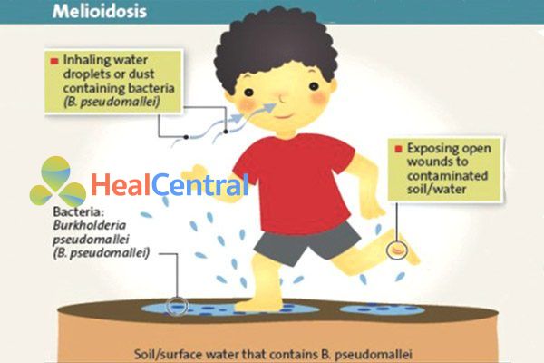 Các con đường lây nhiễm Burkholderia pseudomallei.