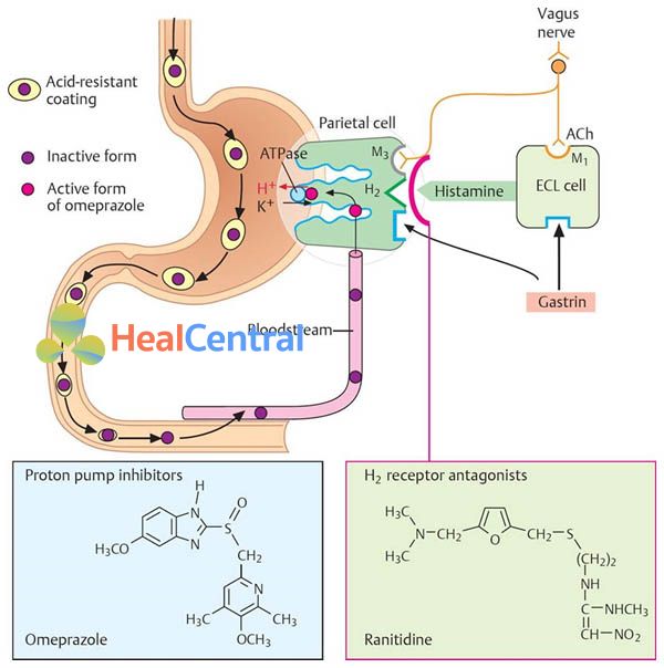 Vị trí tác dụng của PPI (omeprazole) và thuốc kháng histamine H2 (ranitidine).