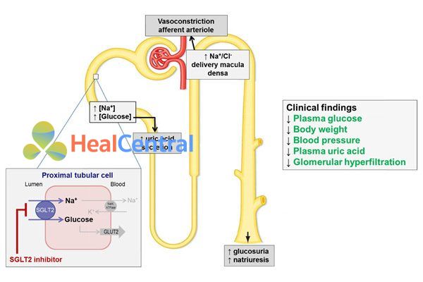 Vị trí tác dụng của các thuốc ức chế SGLT2.