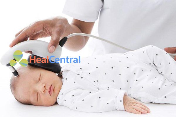 Đánh giá thính giác trẻ sơ sinh