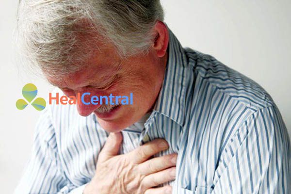 Đau thắt ngực ổn định mạn tính