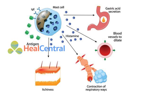 Kháng Histamin chống dị ứng