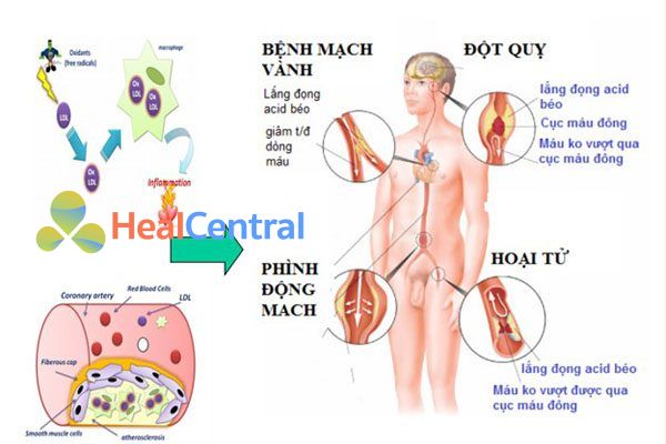 Các hậu quả của tăng cholesterol máu