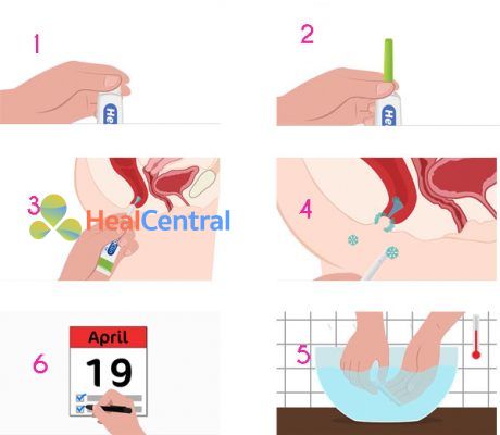 Các bước sử dụng HemoClin