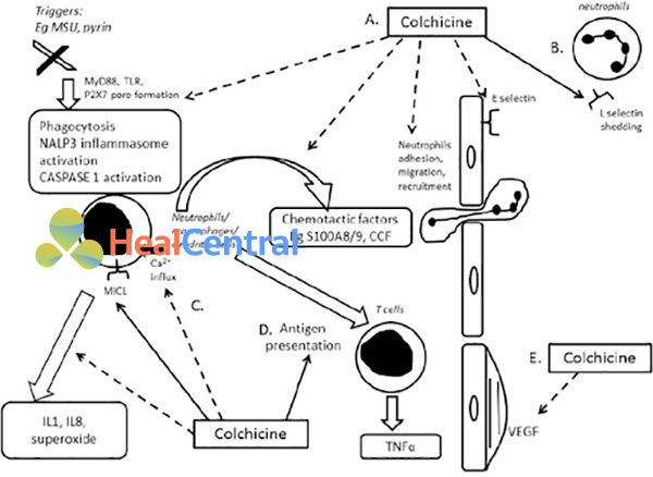 Tóm tắt tác dụng của colchicine trên với đại thực bào