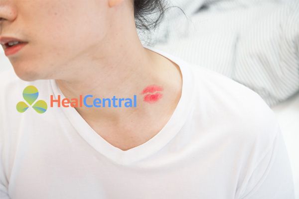 Tạo vết hickey bằng dấu son