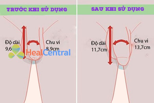 Hiệu quả khi sử dụng Titan Gel Gold