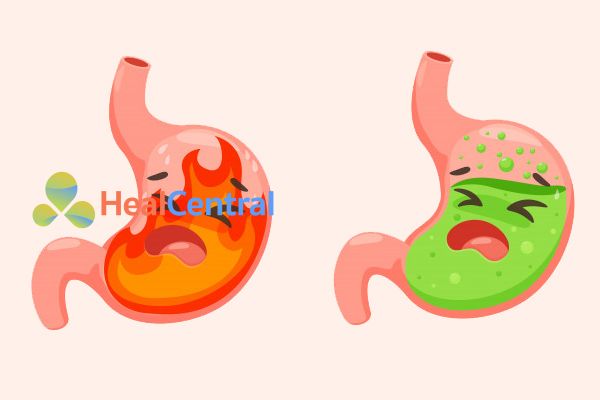 Thuốc Meteospasmyl điều trị rối loạn tiêu hóa