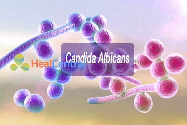 Nấm Candida Albicans thường là nguyên nhân chính gây ra các bệnh âm đạo