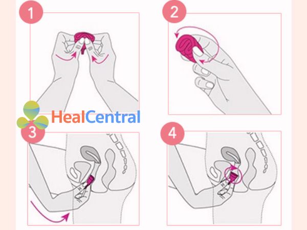 Cách sử dụng cốc nguyệt san ICare