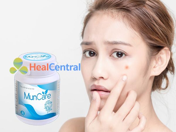 Thuốc trị mụn Muncare - đặc trị mụn trứng cá