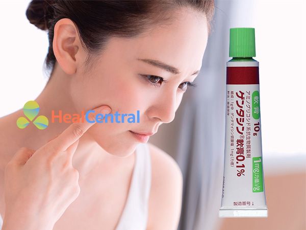 Sản phẩm Gentacin - làm mờ sẹo lồi, sẹo thâm