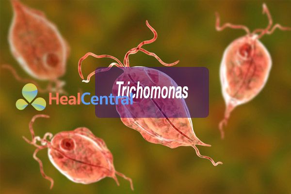 Chủng vi khuẩn Trichomonas