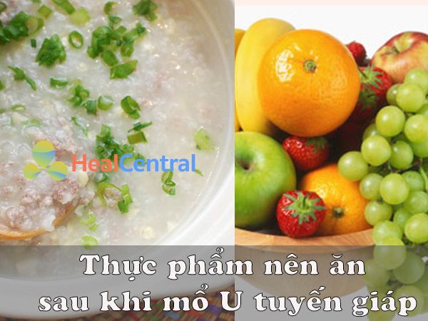 Thực phẩm nên ăn sau khi mổ U tuyến giáp