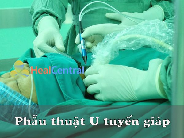 Phẫu thuật U tuyến giáp