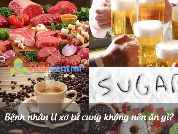 Các thực phẩm bệnh nhân U xơ tử cung không nên ăn