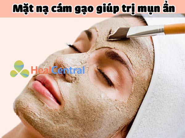 Mặt nạ cám gạo trị mụn ẩn