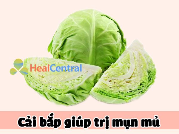 Bắp cải giúp điều trị mụn mủ