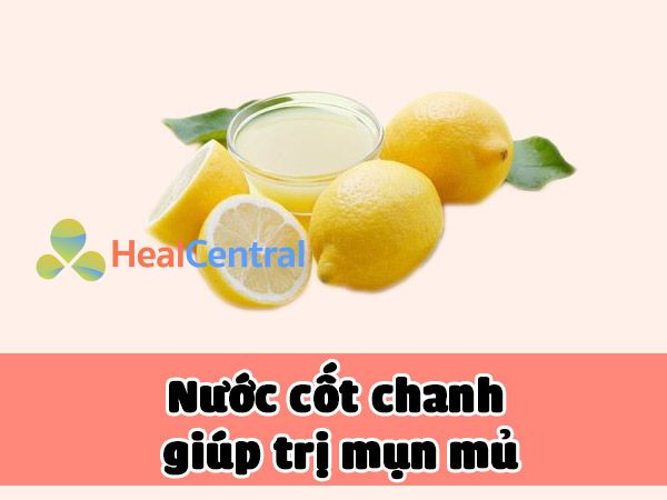 Nước cốt chanh giúp điều trị mụn mủ