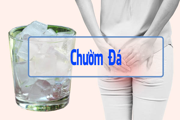 Chườm đá khu vực Hậu Môn giúp bệnh nhân dễ chịu hơn