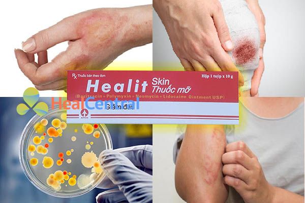 Công dụng của thuốc Healit Skin Ointment