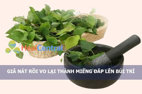 Đắp trực tiếp diếp cá lên búi trĩ