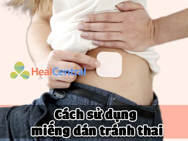 Cách sử dụng miếng dán tránh thai