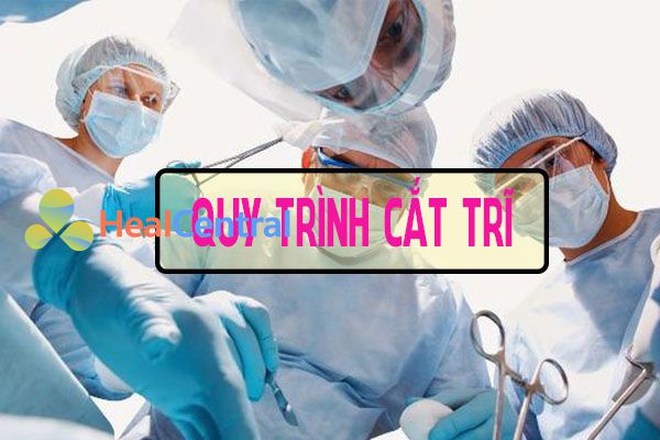 Quy trình cắt trĩ bằng Laser