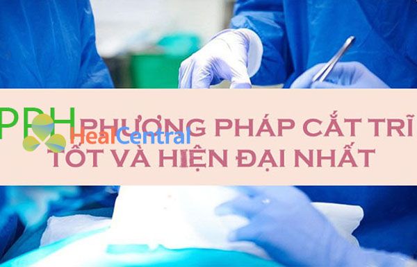 Phương pháp cắt trĩ tốt nhất.