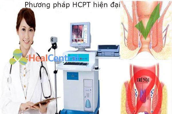 Cắt trĩ bằng phương pháp HCPT.