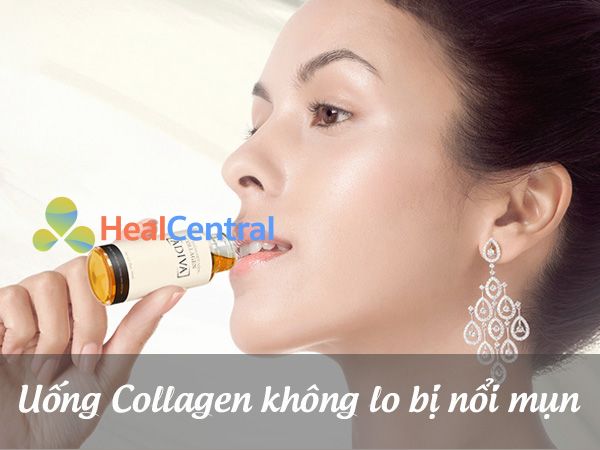 Uống collagen không lo bị nổi mụn