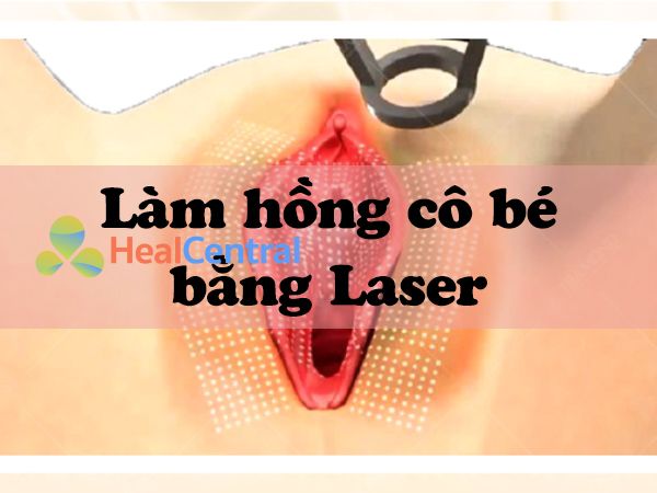 Thẩm mỹ làm hồng cô bé bằng Laser tại Spa hiện đại nhưng "đắt xắt ra miếng"