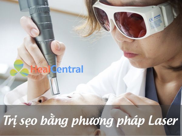 Trị sẹo bằng phương pháp Laser