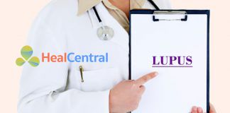 Bệnh Lupus ban đỏ hệ thống