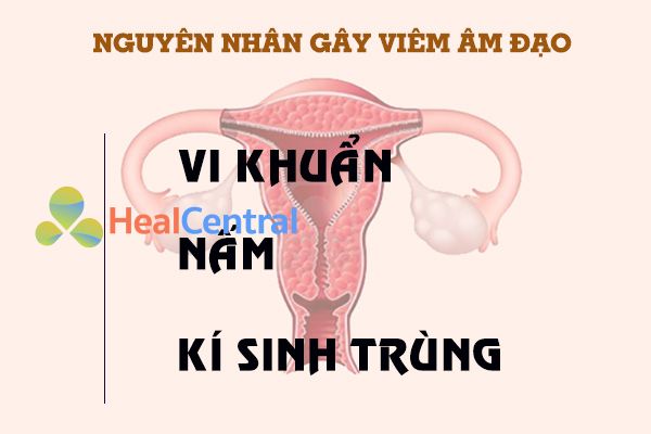 Các nguyên nhân dẫn đến viêm âm đạo