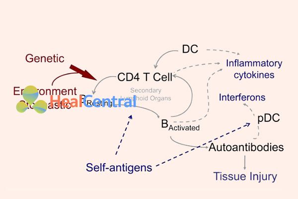 Cơ chế bệnh sinh của Lupus ban đỏ hệ thống