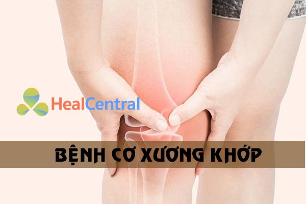 Cơ xương khớp là một căn bệnh thường găp