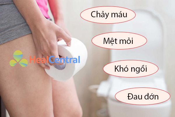 Các triệu chứng của bệnh trĩ