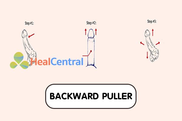 Hướng dẫn bài tập Backward Puller