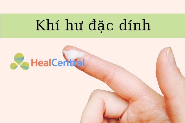 Khí hư đặc dính