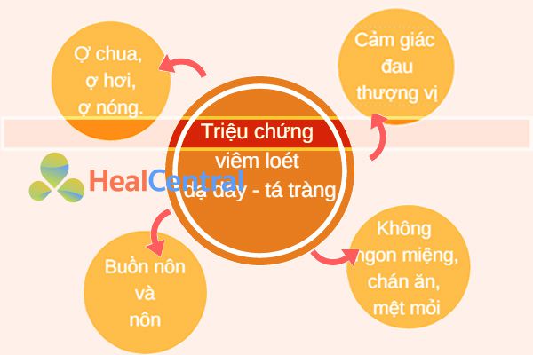 Các triệu chứng điển hình của loét dạ dày-tá tràng