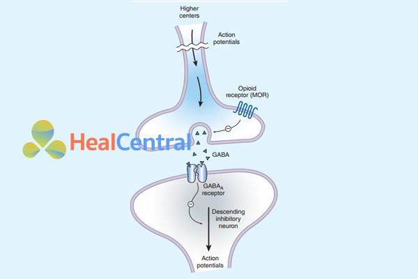 Ảnh: Các neuron ức chế đau được kích hoạt gián tiếp bởi các opioid nội hoặc ngoại sinh, ức chế các tế bào thần kinh trung gian ức chế (hệ GABAergic). Điều này dẫn đến kết quả tăng cường ức chế quá trình đau ở sừng sau tủy sống (hình dưới).