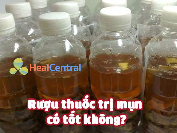 Rượu thuốc trị mụn có tốt không