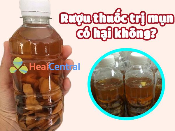 Thuốc rượu trị mụn có tác hại không