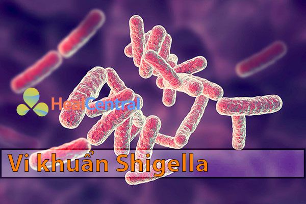 Vi khuẩn Shigella gây hội chứng lỵ