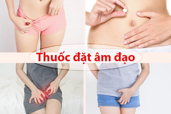 Các thuốc đặt âm đạo hiệu quả và an toàn nhất hiện nay