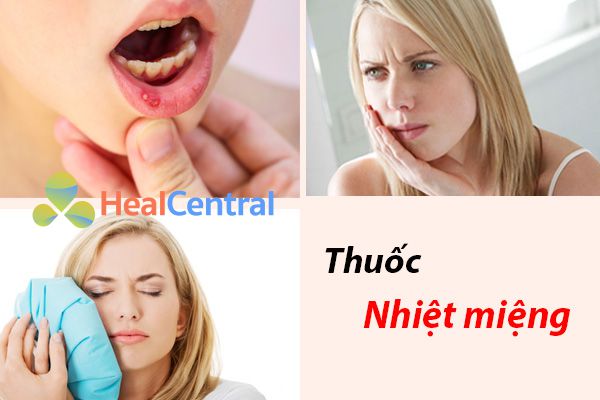 TOP 10 Thuốc điều trị nhiệt miệng tốt và hiệu quả nhất hiện nay