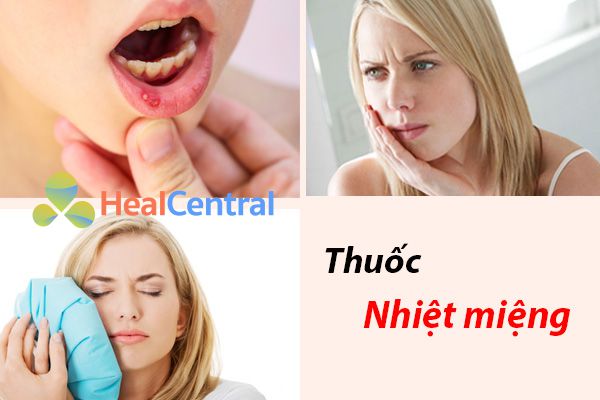 Nhiệt miệng là những vết loét nhỏ màu đỏ hoặc trắng gây đau đớ khó chịu cho bệnh nhân