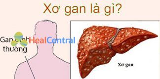 Gan xơ khác gì so với gan bình thường???